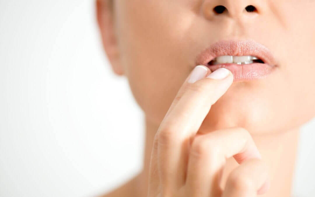 Cold Sore Prescription Treatment: How it Works and How to Request It