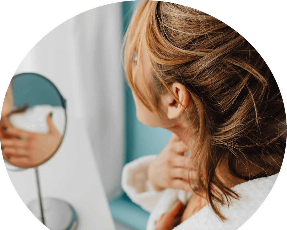 eczema-tr woman-applying-eczema-treatment-prescribed-by-webdoctor.ie