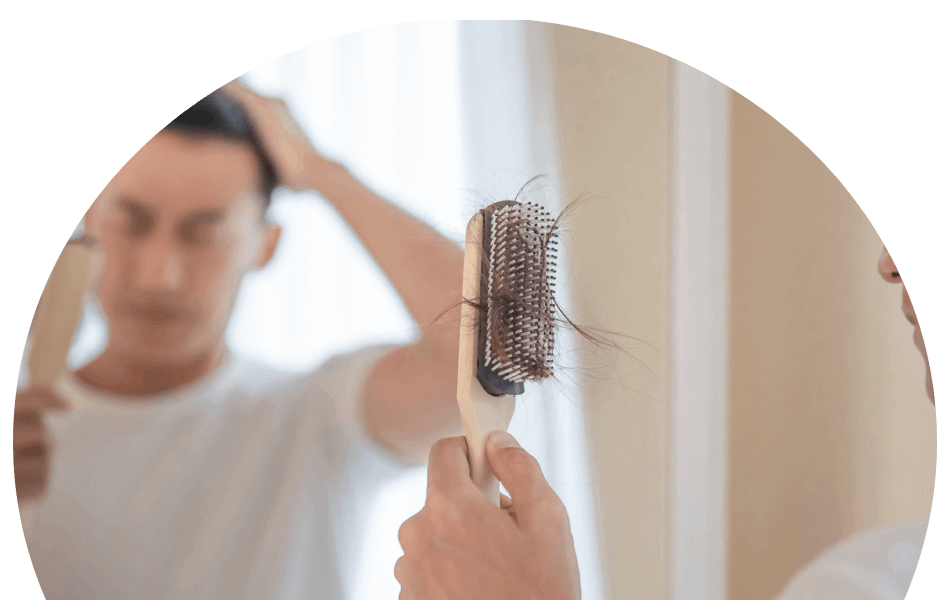 man-brushing-thinning-hair