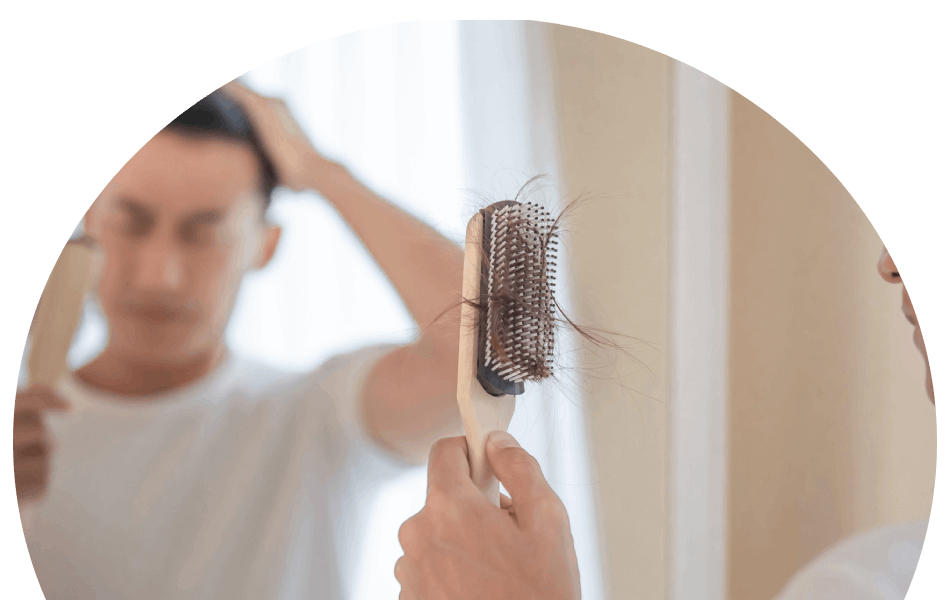 Hair-Loss-Hero man-brushing-thinning-hair