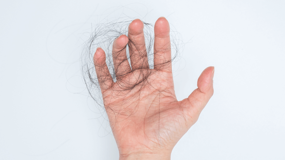 man-holding-hair-in-hand-after-hair-fell-out
