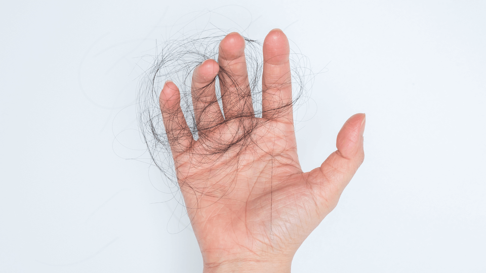 rsz_1hair_loss_1 man-holding-hair-in-hand-after-hair-fell-out