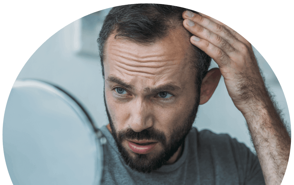 man-checking-for-male-pattern-hair-loss-in-mirror